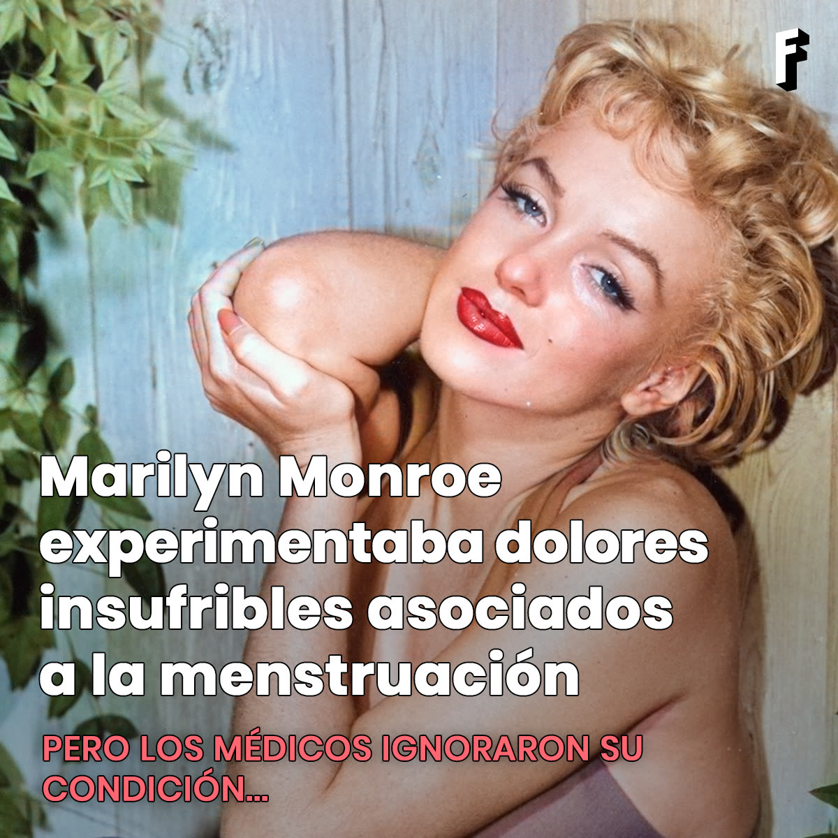 Carosello sull'endometriosi di Marilyn Monroe, fotogramma 1 di 7