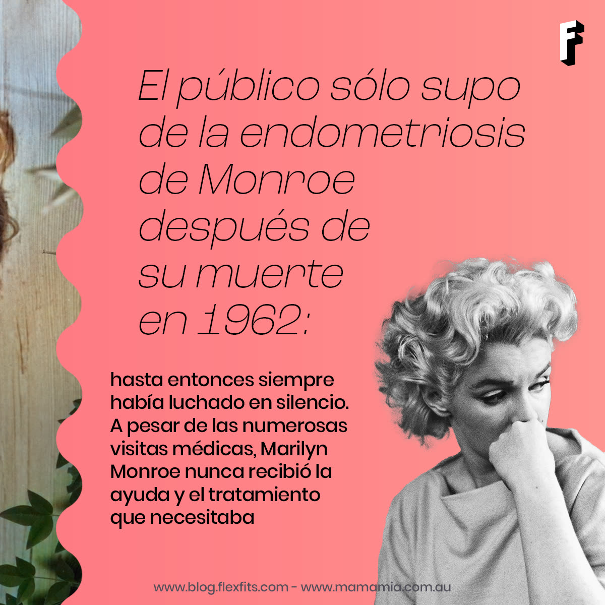 Carosello sull'endometriosi di Marilyn Monroe, fotogramma 2 di 7