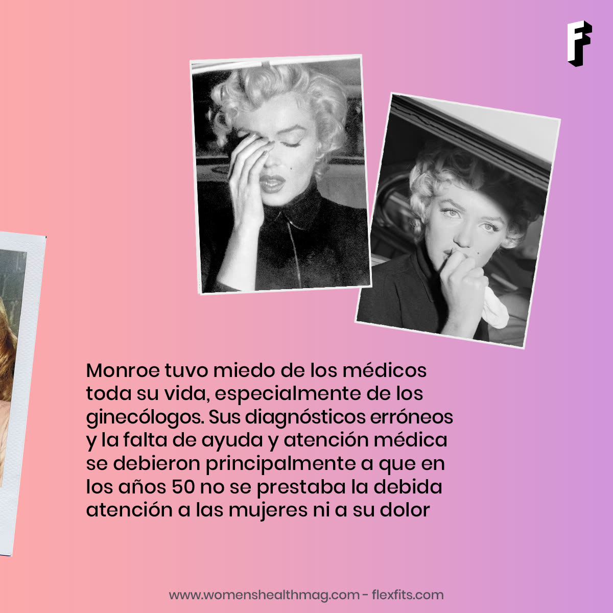 Carosello sull'endometriosi di Marilyn Monroe, fotogramma 4 di 7